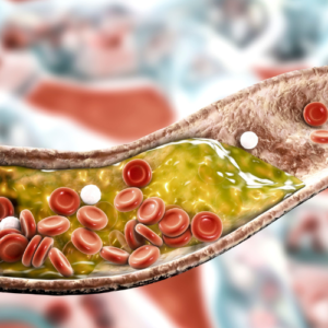 Weight, Heart and Circulatory Diseases